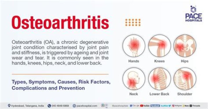 How painful is osteoarthritis of the spine?