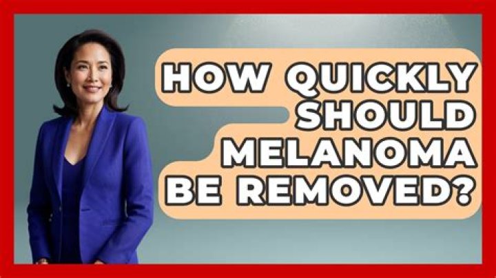How quickly should melanoma be removed?
