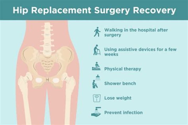 How soon after hip replacement can I shower?