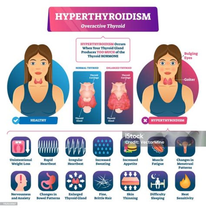 Is a swollen thyroid an emergency?