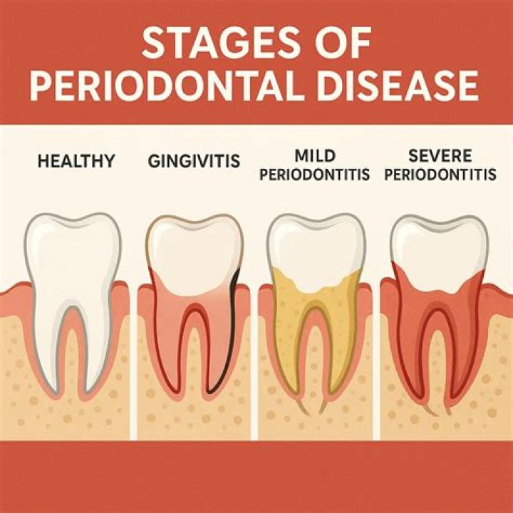 Is chronic periodontitis painful?