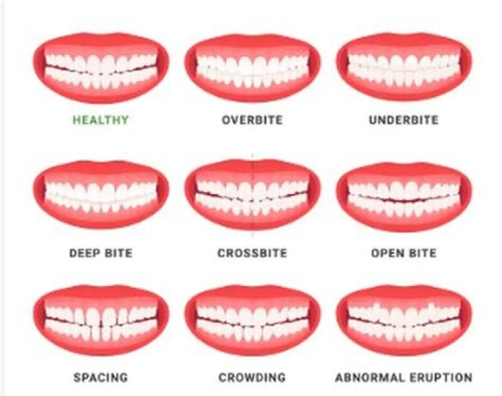 Is having crooked teeth OK?