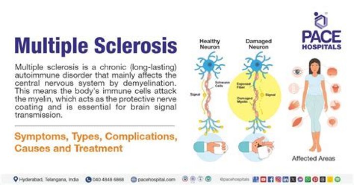 Is ice good for multiple sclerosis?