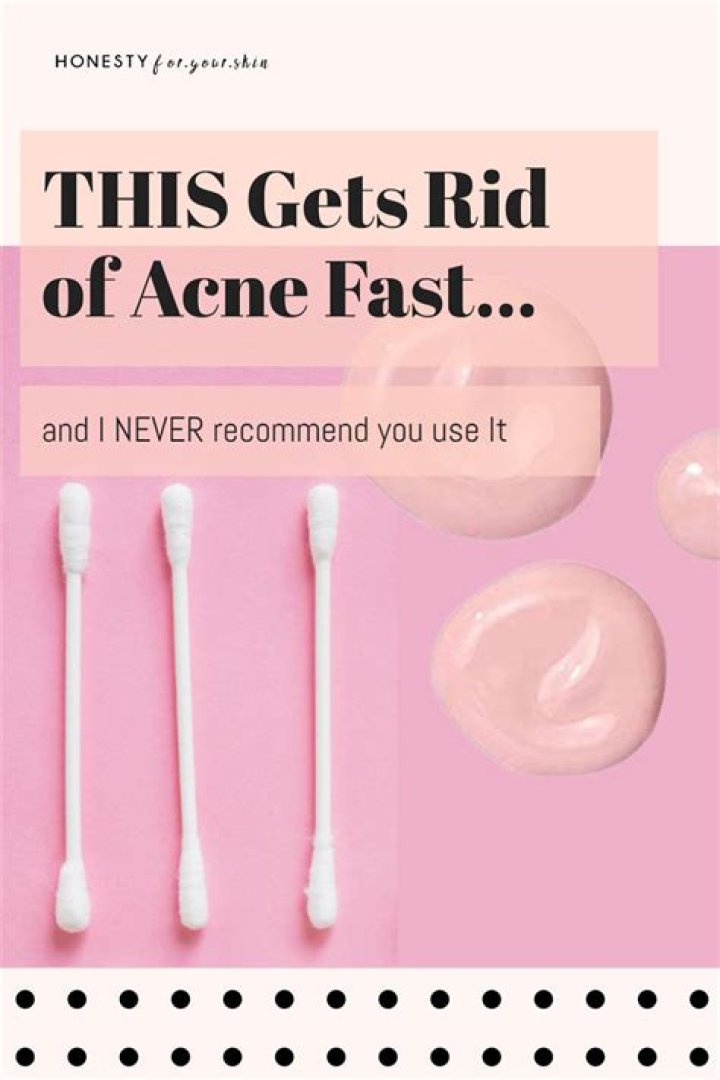 Is it better to dry out or moisturize a pimple?