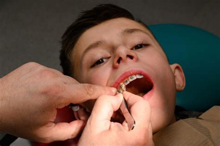 Is it OK to leave salt on teeth?