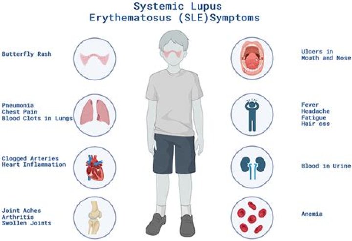 Is lupus worse in the cold?
