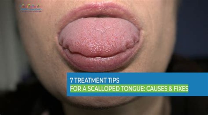 Is my tongue supposed to touch my bottom teeth?