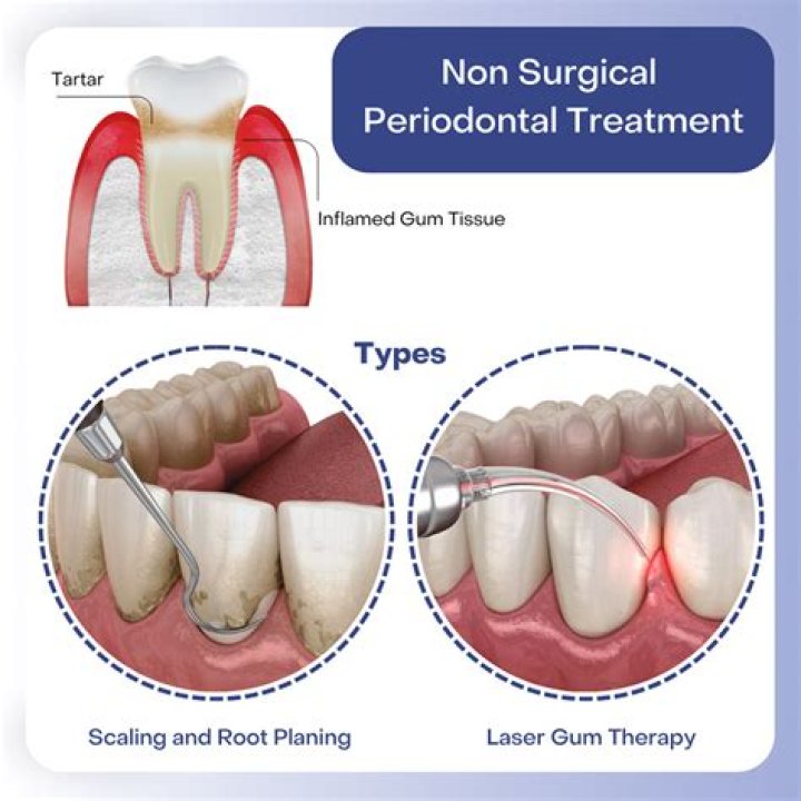 Is non surgical periodontal treatment painful?