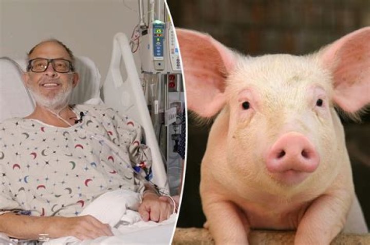 Is pig heart patient still alive?