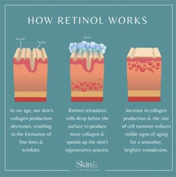 Is retinol or glycolic acid better?