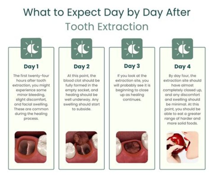 Should I still have pain 5 days after wisdom tooth extraction?