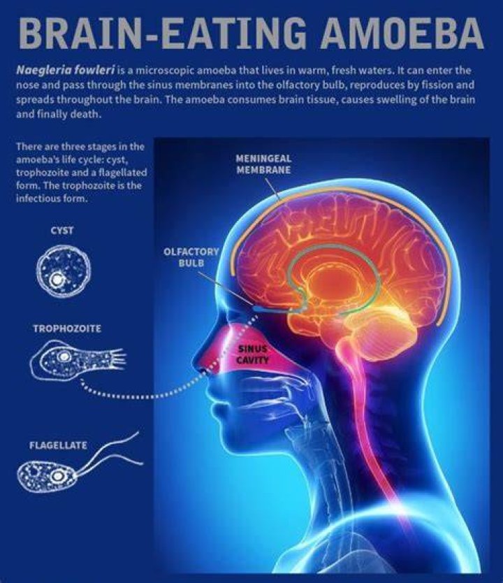 Should I worry about brain eating amoeba?