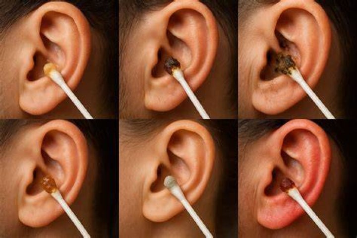 Should my earwax smell?