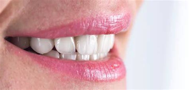 Should your teeth be whiter than your eyes?