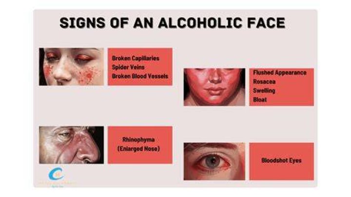 What alcohol makes you blind?