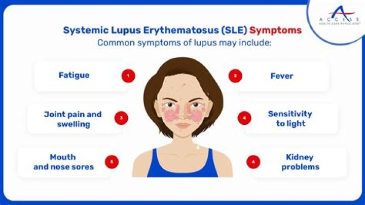 What ANA pattern is lupus?