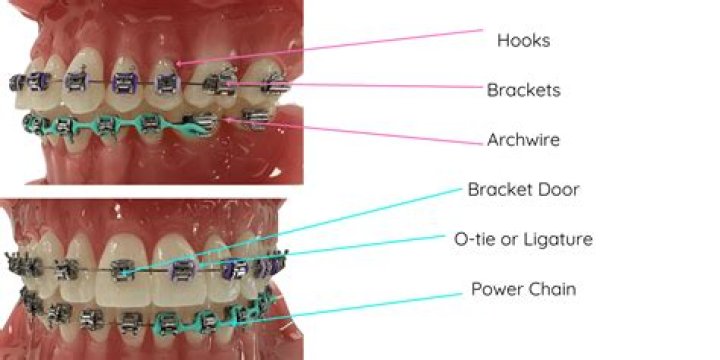 What are braces between studs called?