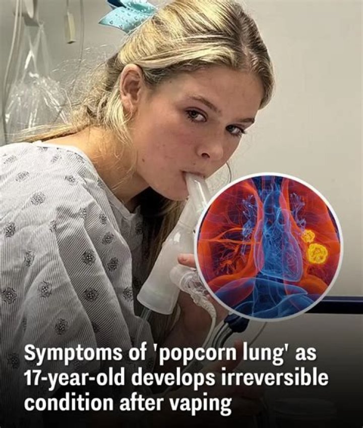 What are popcorn lungs?