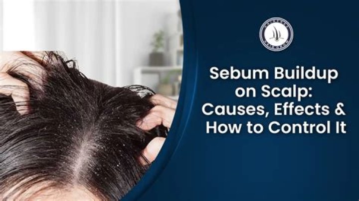 What are sebum balls?