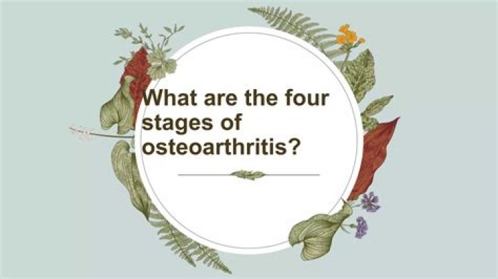 What are the four stages of osteoarthritis?