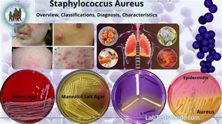 What are the symptoms of heavy growth of Staphylococcus?