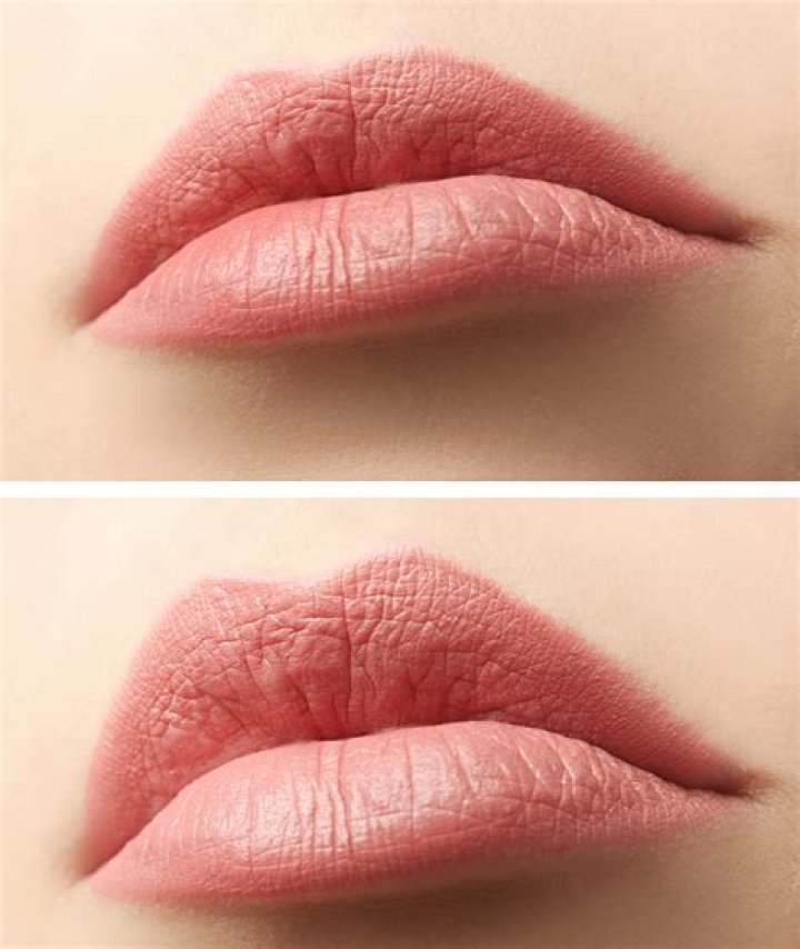 What are thin lips?