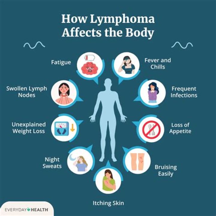What can be confused with lymphoma?