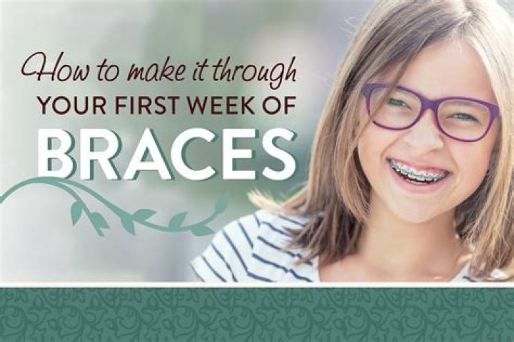 What can I eat with braces first week?