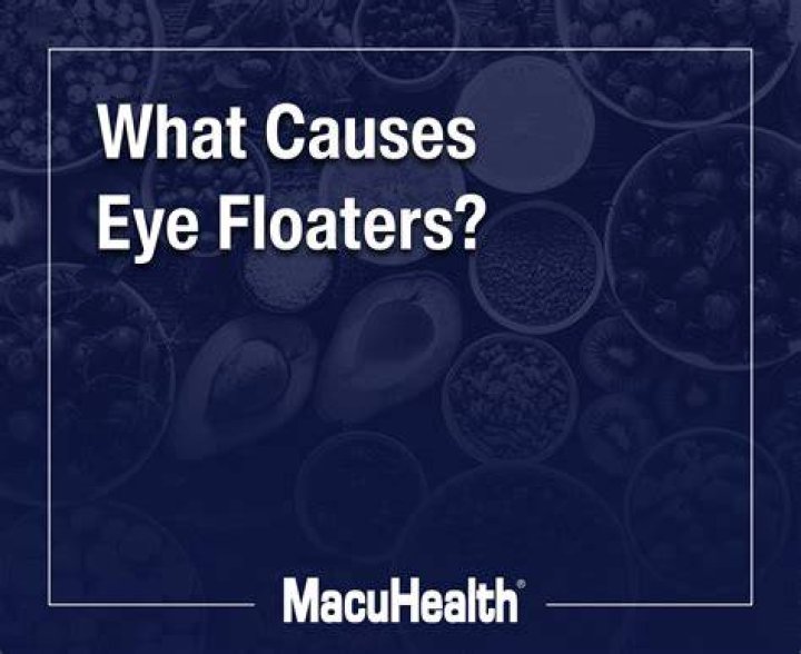 What causes black floaters in your eyes?