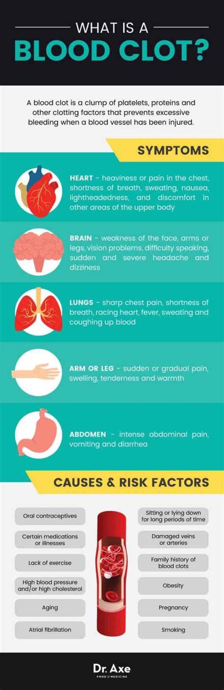 What causes blood clot?