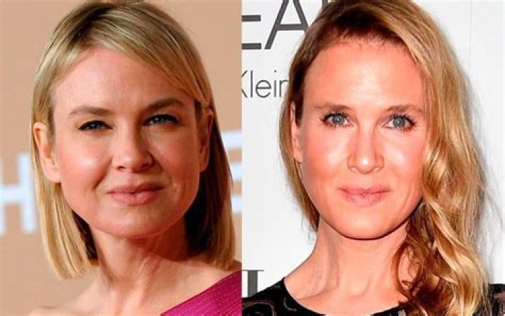 What celebrities have RA?