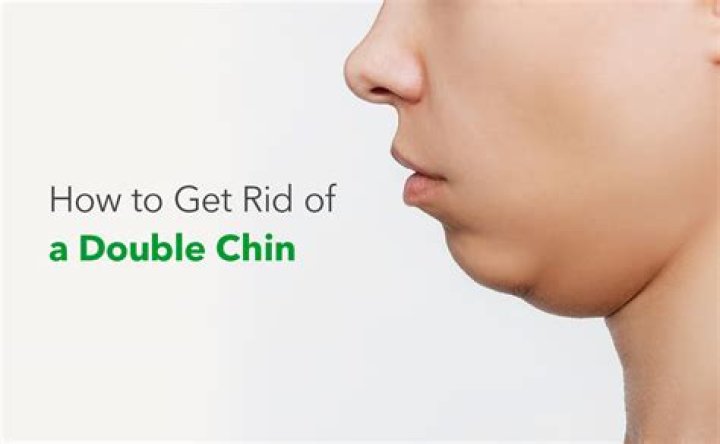 What do celebrities do for double chin?