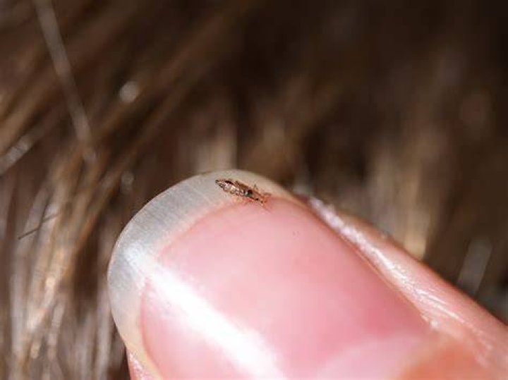 What do lice taste like?