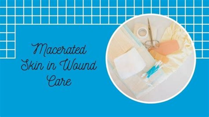 What does a macerated wound look like?