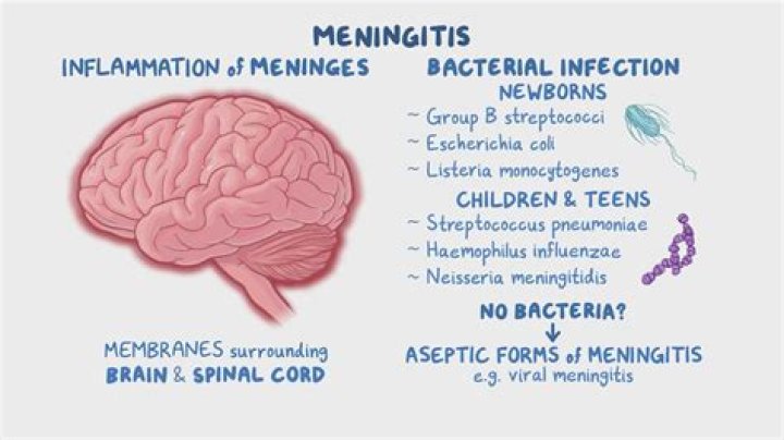 What does bacterial meningitis feel like?