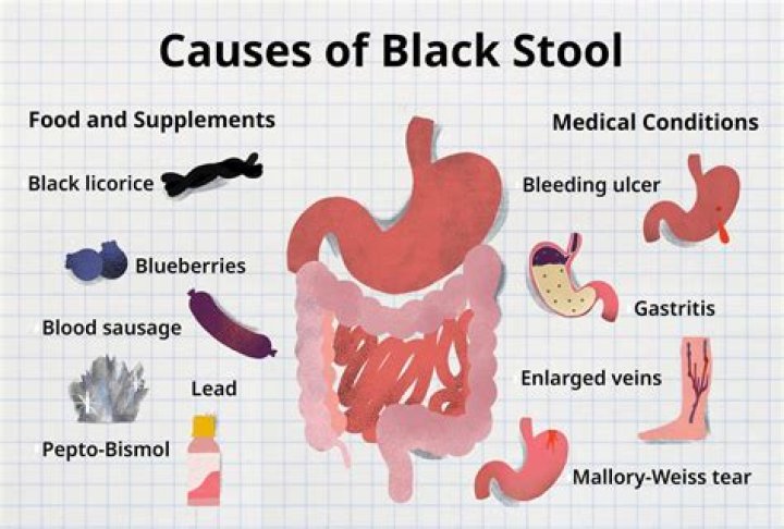 What does black poop look like?