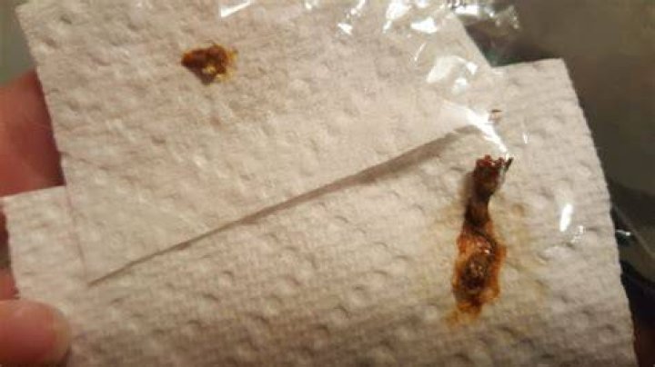 What does blood in poo look like?