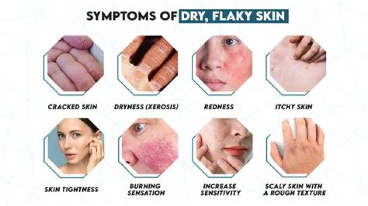 What does flaking out mean?