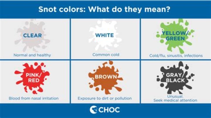 What does GREY snot mean?
