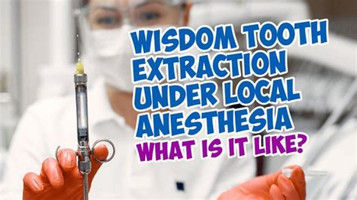 What does it feel like to be put under anesthesia for wisdom teeth?