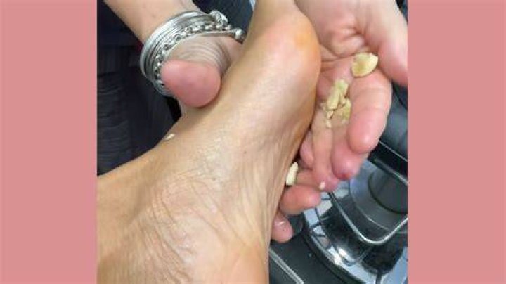 What does rubbing garlic on your feet do?