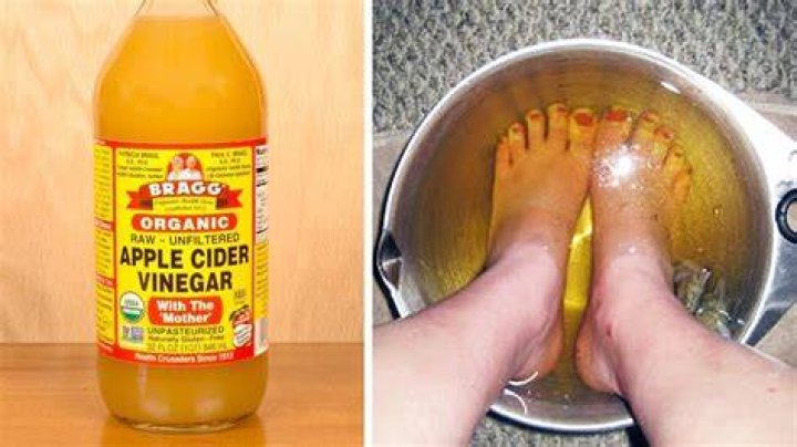 What does soaking your feet in apple cider vinegar do for your body?