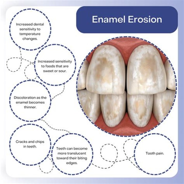 What happens if enamel is gone?