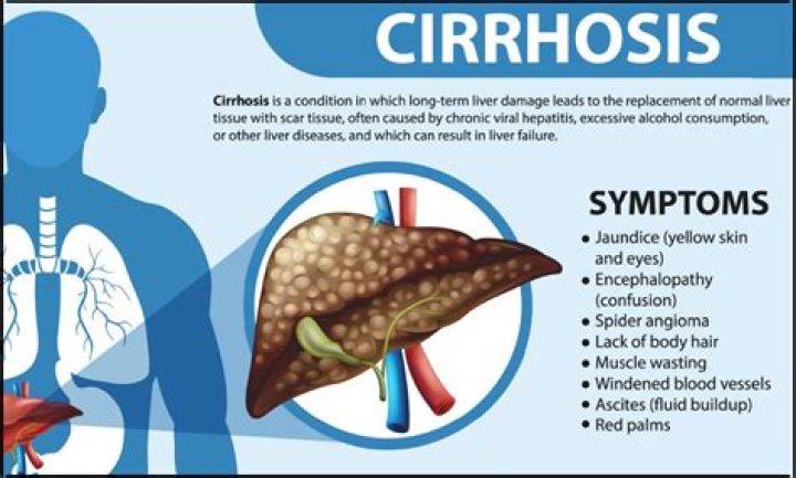 What happens if you keep drinking with cirrhosis?