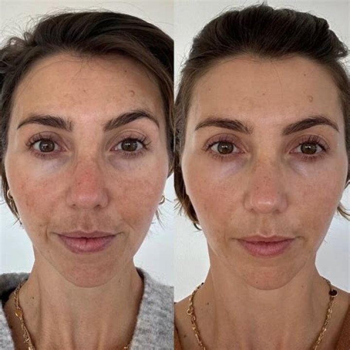 What happens if you put makeup on after microneedling?