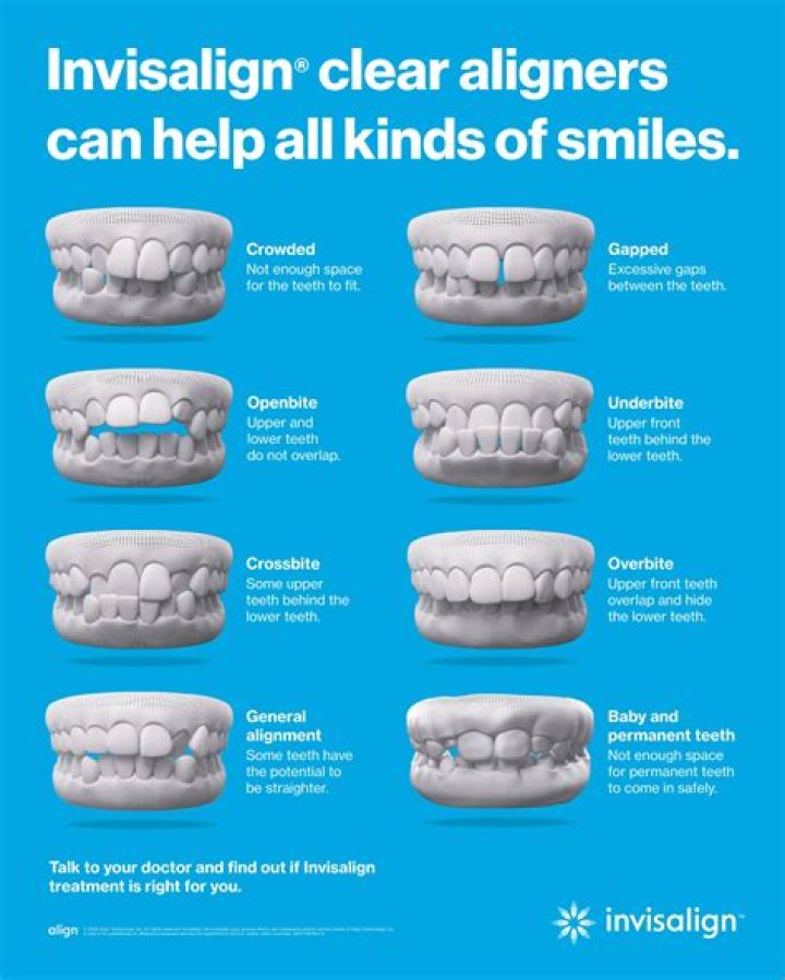 What happens if you swallow an Invisalign attachments?