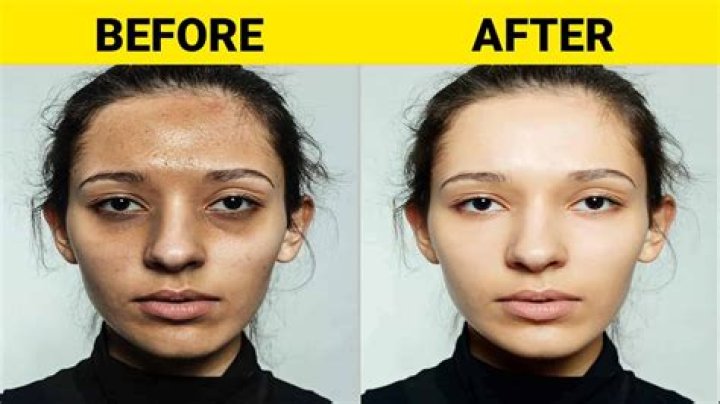 What happens to your face when you stop drinking?
