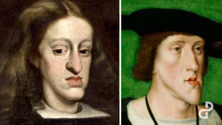 What is a Habsburg jaw line?