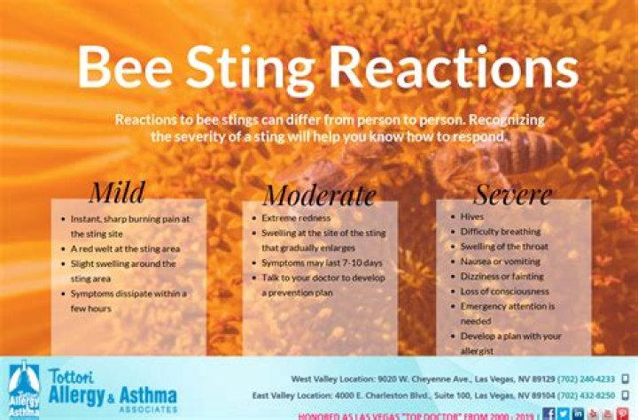 What is a mild reaction to a wasp sting?