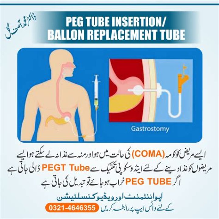 What is a sugary Peg?